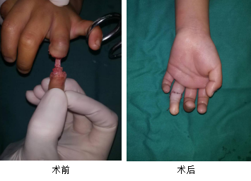 <a href='http://www.tanmianxu.com/' target='_blank'><u>徐州仁慈醫(yī)院</u></a>手外科