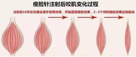 包子臉